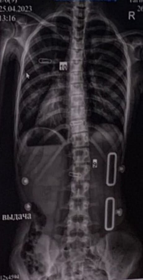 После После